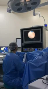 dr-fabrisio-barbosa-blog-HOLEP-Tecnica-Avancada-para-o-Tratamento-da-Hiperplasia-Prostatica-Benigna-5
